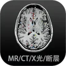 影像解剖图谱 4.5.5 - 玄熵冰河游戏系统工具下载（大小：61.74MB）